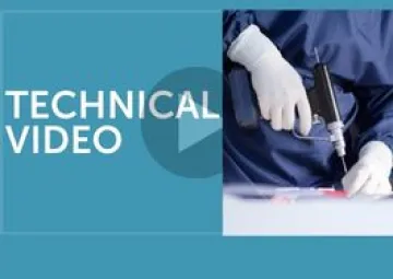 
Step by step single tunnel ACL reconstruction through anteromedial portal
