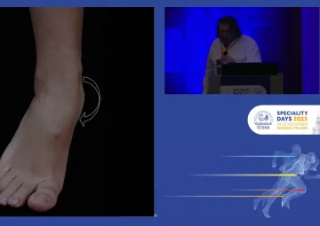 European perspective on medial instability